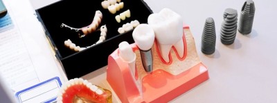 宁波种牙哪家医院好，宁波鼎植口腔医院口碑更好