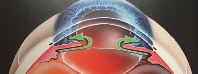 青白联合 共筑光明——2026何氏眼科青光眼白内障联合防治月启幕